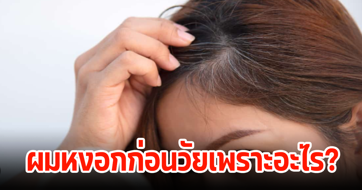 ใครสงสัย? สาเหตุที่ทำให้เกิด ผมหงอก-ผมขาว ก่อยวัย