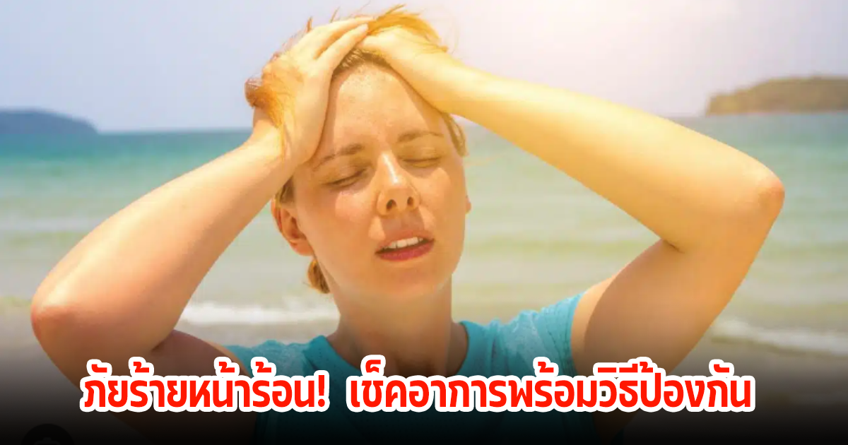 ภัยร้ายหน้าร้อน! โรคลมแดด หรือ ฮีทสโตรก เช็คอาการพร้อมวิธีป้องกัน