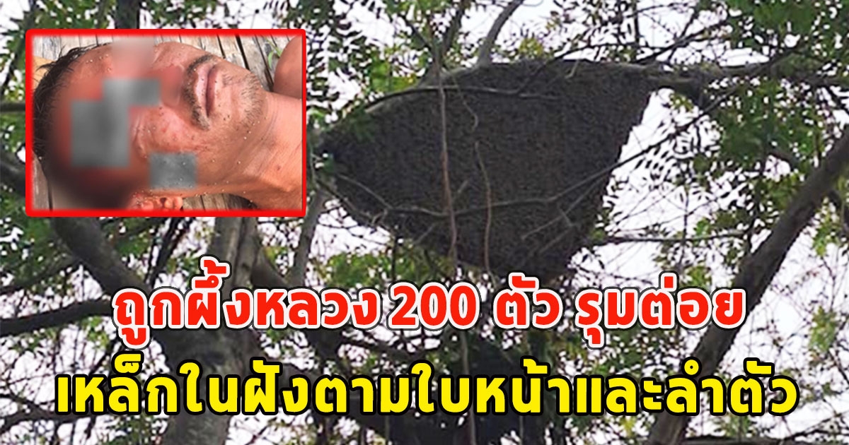 ชาย40 ปี ช่วยชาวบ้านกำจัดรังผึ้งหลวงพลาด ถูกผึ้งหลวง 200 ตัว รุมต่อย เหล็กในฝังตามใบหน้าและลำตัว