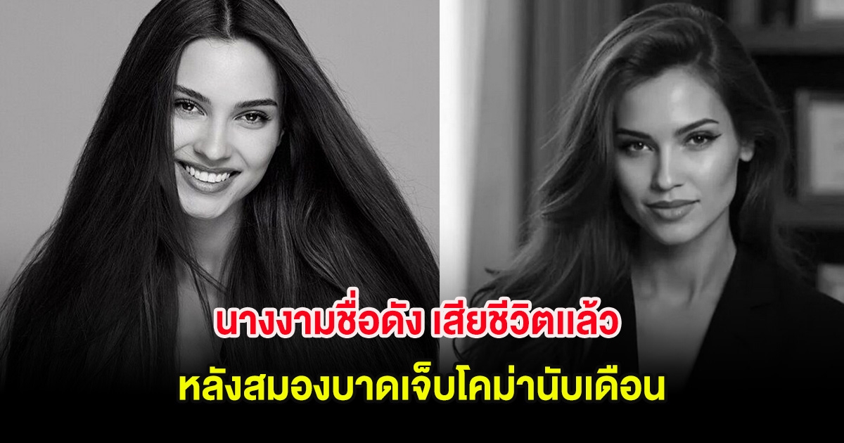 สะเทือนวงการ นางงามชื่อดัง เสียชีวิตเเล้ว หลังสมองบาดเจ็บโคม่านับเดือน (ต่างประเทศ)