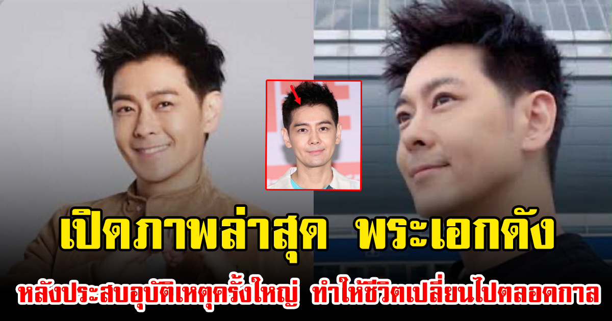 เปิดภาพล่าสุด พระเอกดัง หลังประสบอุบัติเหตุครั้งใหญ่ ทำให้ชีวิตเปลี่ยนไปตลอดกาล (ข่าวต่างประเทศ)