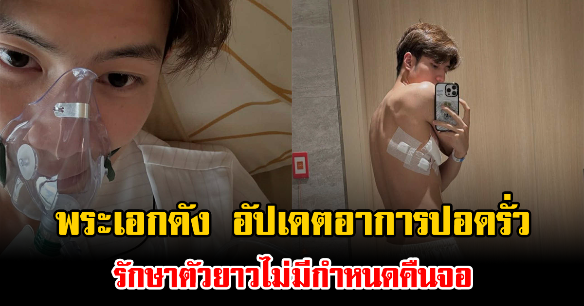 แฟนๆแห่ส่งกำลังใจ พระเอกดัง อัปเดตอาการปอดรั่ว รักษาตัวยาวไม่มีกำหนดคืนจอ