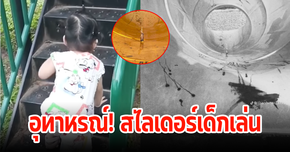 อุทาหรณ์ แม่แทบกรี๊ด หลังลูกเล่นสไลเดอร์ในสวนสาธารณะ