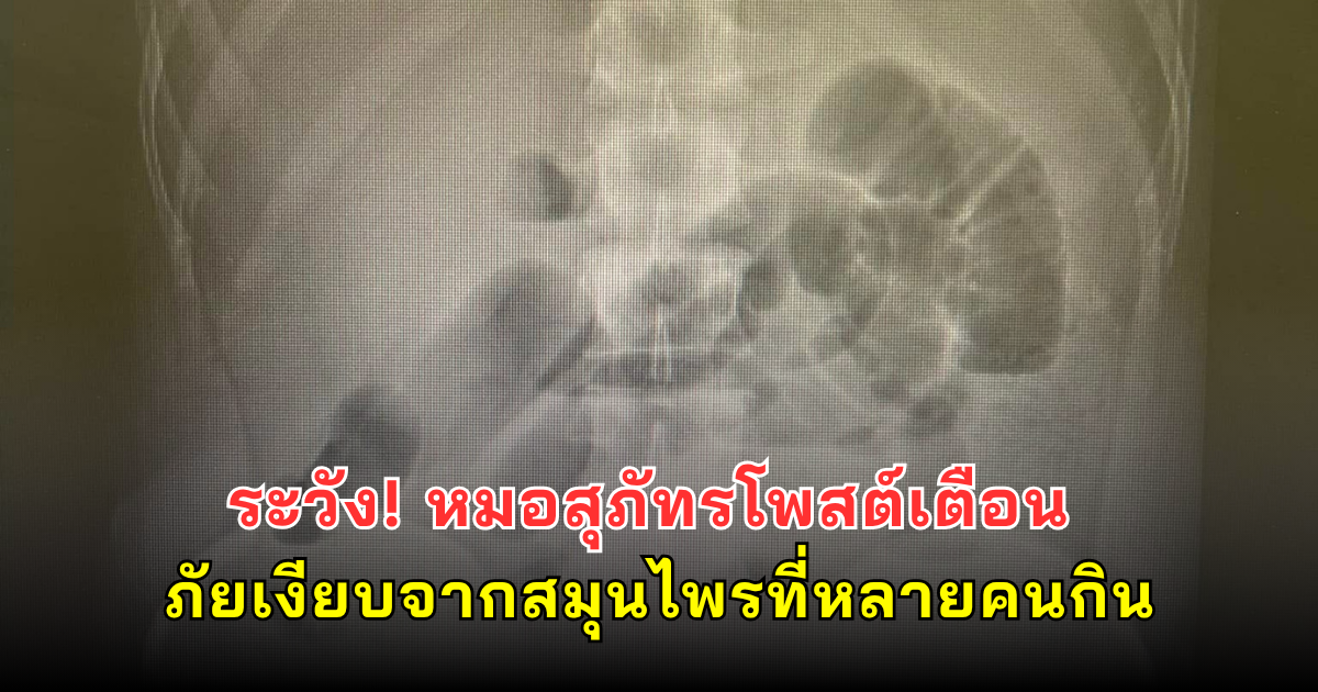 ระวัง! หมอสุภัทรโพสต์เตือน ภัยเงียบจากสมุนไพรที่หลายคนกิน