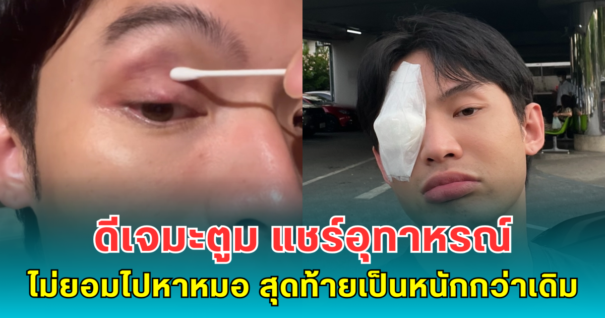 บทเรียนครั้งใหญ่ ดีเจมะตูม แชร์อุทาหรณ์จากความดื้อ ไม่ยอมไปหาหมอ สุดท้ายเป็นหนักกว่าเดิม