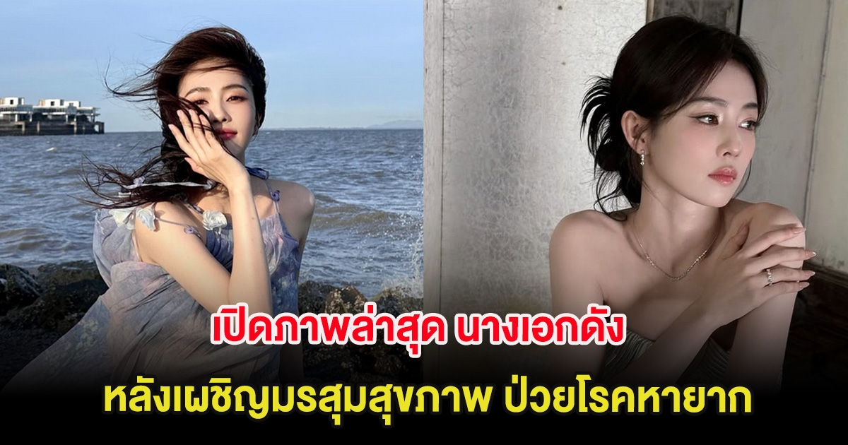 เปิดภาพล่าสุด นางเอกดัง หลังเผชิญมรสุมสุขภาพ ป่วยโรคหายาก (ต่างประเทศ)