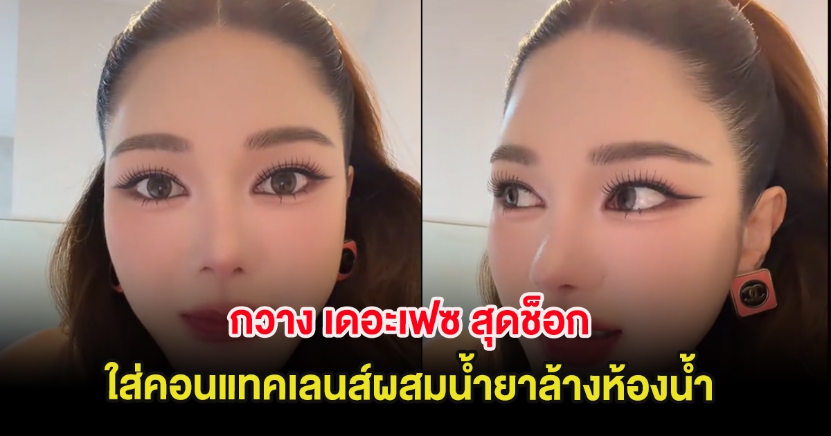 กวาง เดอะเฟซ สุดช็อก ใส่คอนแทคเลนส์ผสมน้ำยาล้างห้องน้ำ พีคสุดอยู่ในตาเป็นปีแล้ว