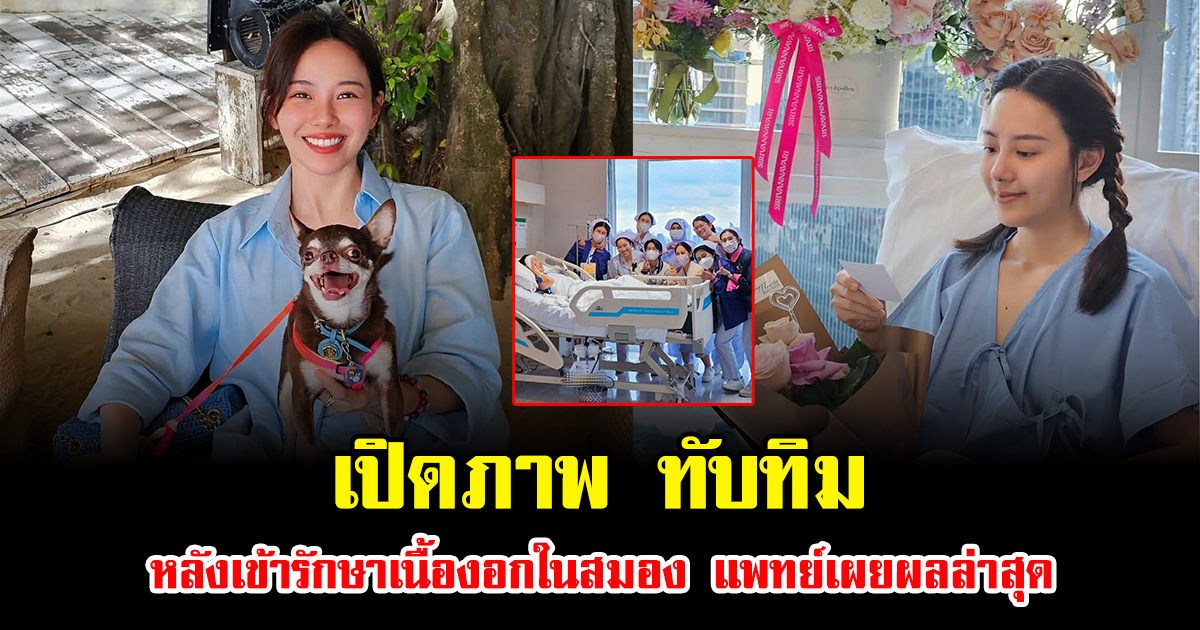 เปิดภาพ ทับทิม หลังเข้ารักษาเนื้องอกในสมอง แพทย์เผยผลล่าสุด