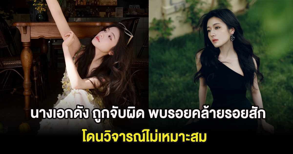 งานเข้า นางเอกดัง ถูกจับผิด พบรอยคล้ายรอยสักที่เเขน โดนวิจารณ์ไม่เหมาะสม (ต่างประเทศ)