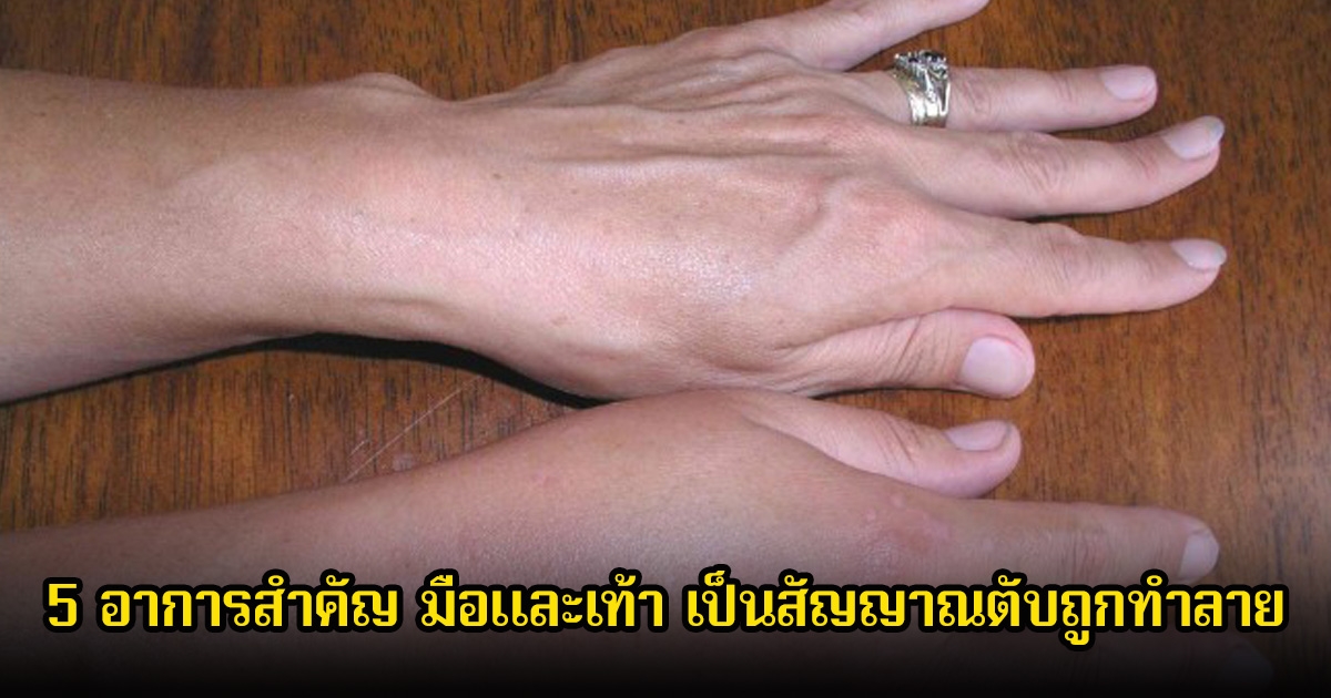 รีบสังเกตด่วน! 5 อาการสำคัญ มือและเท้า เป็นสัญญาณตับถูกทำลาย