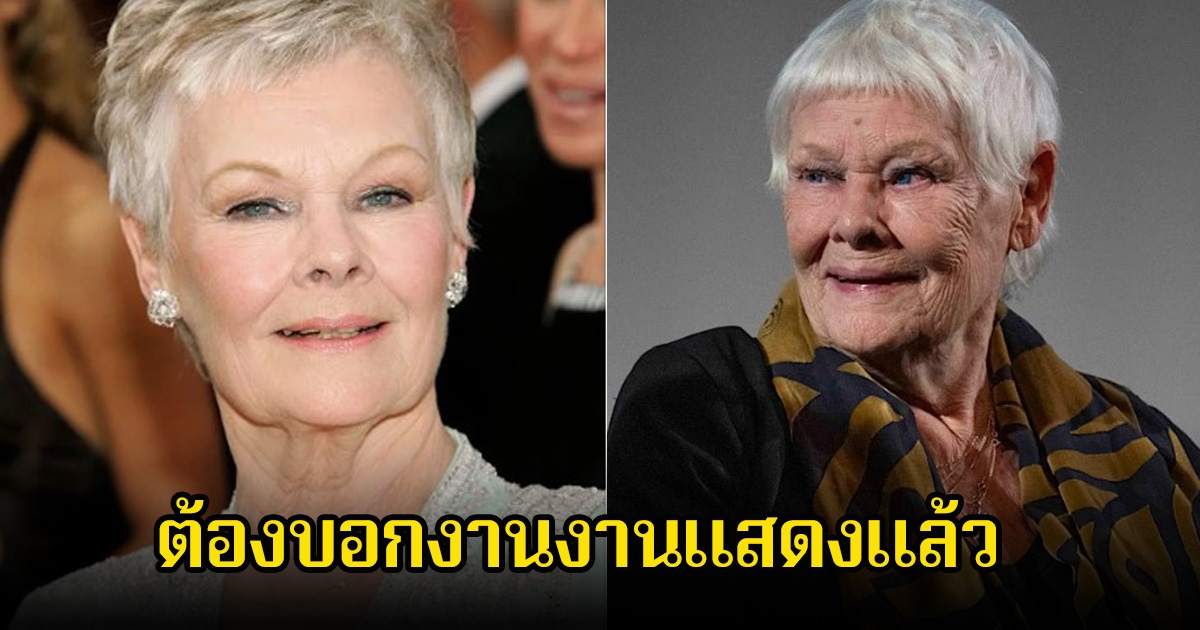 ดารารุ่นใหญ่ ต้องบอกลางานในวงการ หลังตามองไม่เห็น ยอมรับจำใครไม่ได้แล้ว (ข่าวต่างประเทศ)