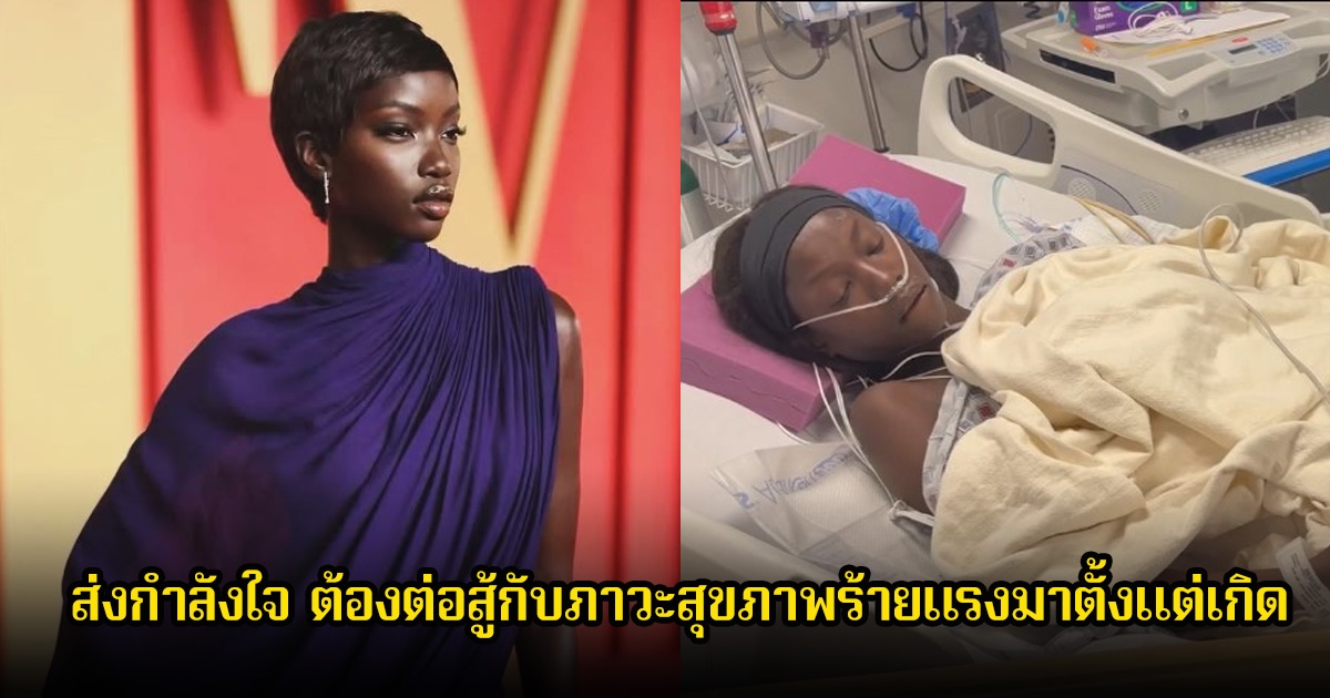 ส่งกำลังใจ นางแบบดัง ป่วยหนัก ต้องต่อสู้กับภาวะสุขภาพร้ายแรงมาตั้งแต่เกิด (ข่าวต่างประเทศ)