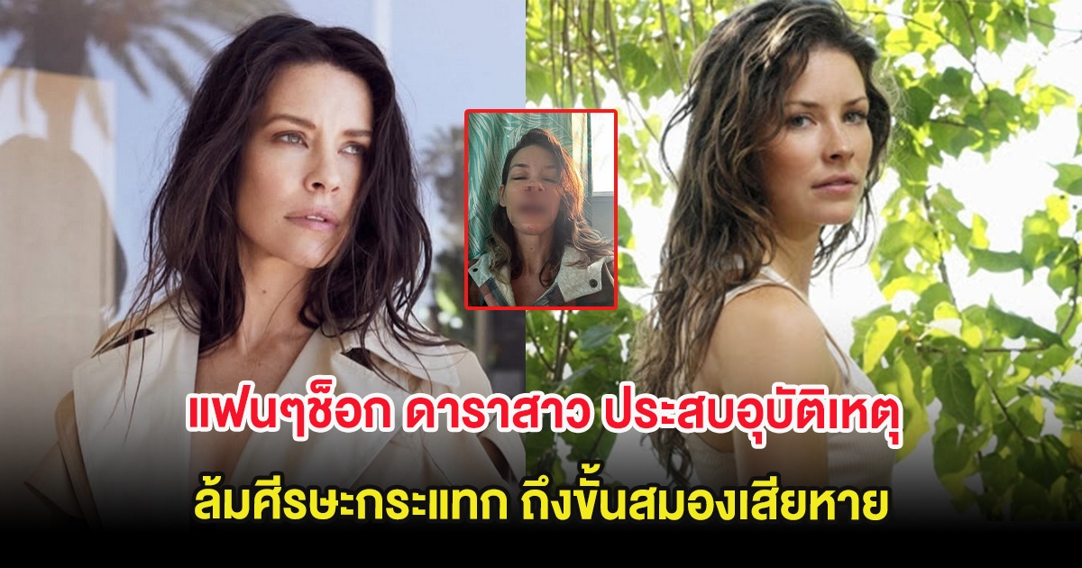 แฟนๆช็อก ดาราสาว ประสบอุบัติเหตุล้มศีรษะกระแทก ถึงขั้นสมองเสียหาย (ต่างประเทศ)