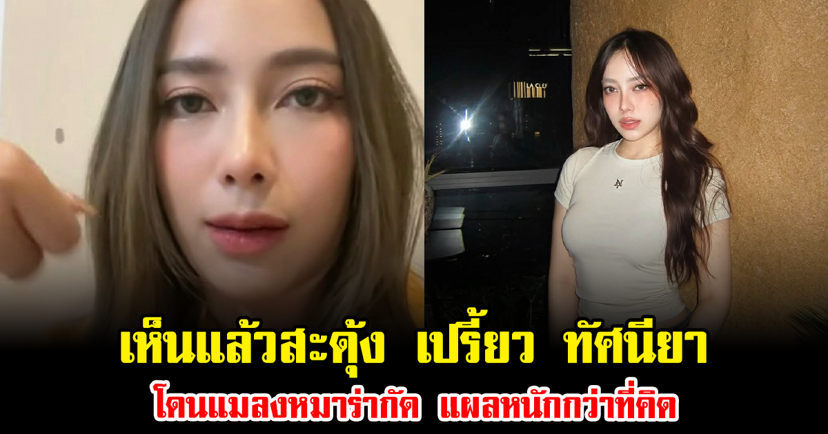 เห็นแล้วสะดุ้ง เปรี้ยว ทัศนียา โดนแมลงหมาร่ากัด แผลหนักกว่าที่คิด