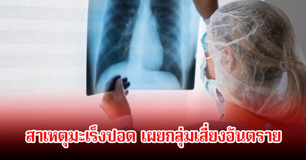 อย่าชะล่าใจ! สาเหตุมะเร็งปอด เผยกลุ่มเสี่ยงอันตราย หลายคนมองข้ามไปเลย