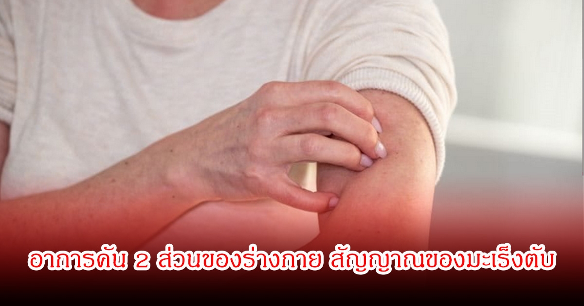 เตือน! อาการคัน 2 ส่วนของร่างกาย สัญญาณของมะเร็งตับ ไม่ใช่อาการแพ้ หลายคนเป็นอยู่