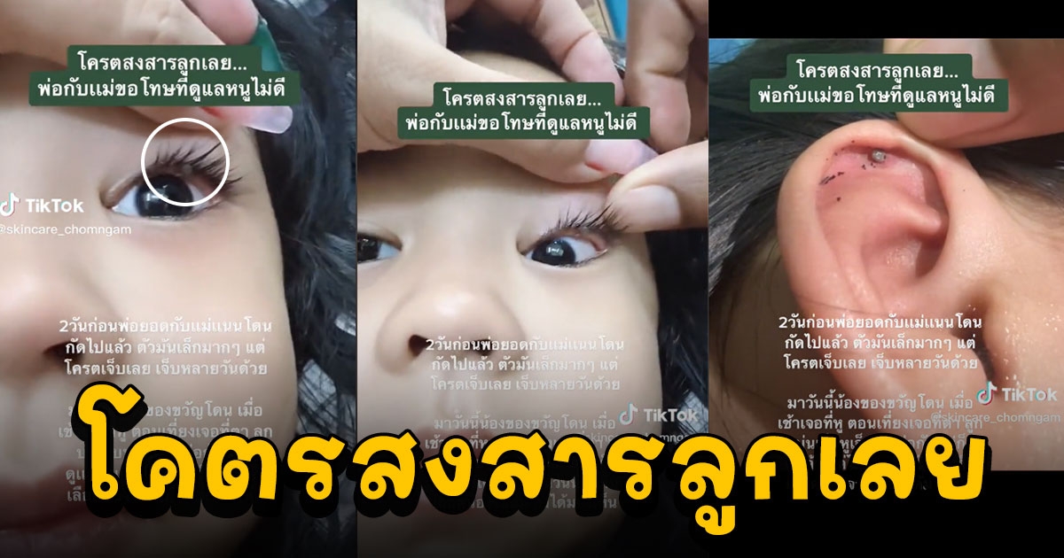 พ่อแม่ใจสลาย ลูกสาวบ่นเจ็บหูเจ็บตา ไม่รู้สาเหตุ ผ่านไป 2 วัน ถึงเจอต้นตอ