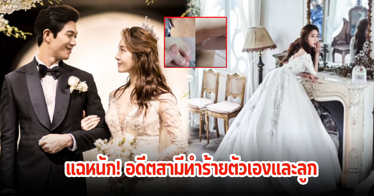 แฉสนั่นโซเชียล! อดีตนักร้องสาว ถูกอดีตสามีทำร้ายร่างกายตัวเองและลูก (ข่าวต่างประเทศ)