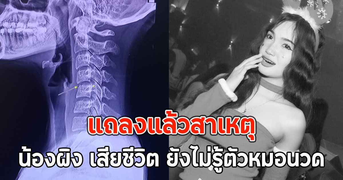 แถลงแล้วสาเหตุ น้องผิง เสียชีวิต ยังไม่รู้ตัวหมอนวด