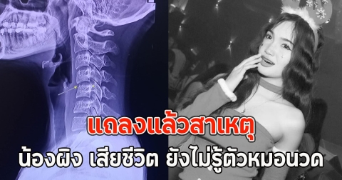 แถลงแล้วสาเหตุ น้องผิง เสียชีวิต ยังไม่รู้ตัวหมอนวด