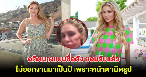 อดีตนางแบบชื่อดัง ยอมรับเเล้ว ไม่ออกงานมาเป็นปี เพราะหน้าตาผิดรูป (ต่างประเทศ)