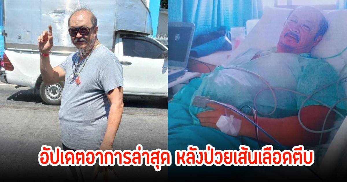 ชีวิตวิกฤต! นักแสดงรุ่นใหญ่ อัปเดตอาการล่าสุด หลังป่วยเส้นเลือดตีบ