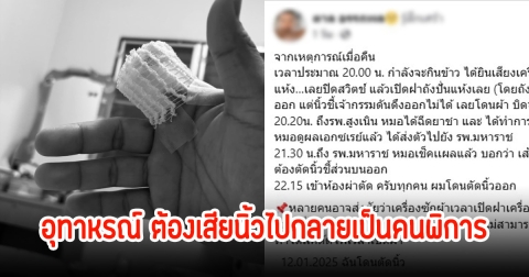 หนุ่มเผยอุทาหรณ์ ต้องเสียนิ้วไปเพราะเครื่องปั่นผ้า กลายเป็นคนพิการ เสียใจอาจจะไม่ได้กลับไปเล่นดนตรีอีก