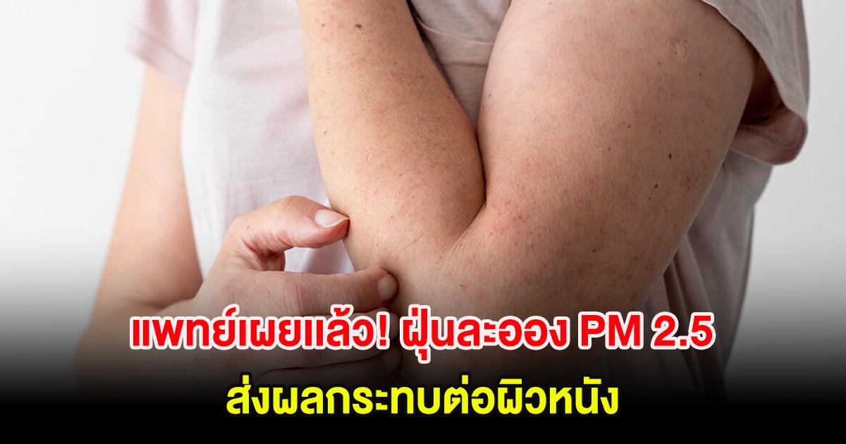 แพทย์เผยเเล้ว! ฝุ่นละออง PM 2.5 ส่งผลกระทบต่อผิวหนัง พร้อมเผยวิธีลดความเสี่ยง