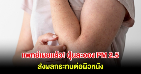แพทย์เผยเเล้ว! ฝุ่นละออง PM 2.5 ส่งผลกระทบต่อผิวหนัง พร้อมเผยวิธีลดความเสี่ยง