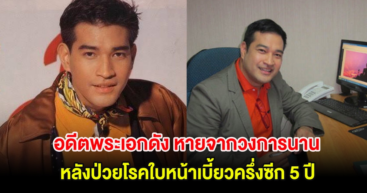 อดีตพระเอกดัง หายจากวงการนาน หลังป่วยโรคใบหน้าเบี้ยวครึ่งซีก 5 ปี ล่าสุดยังไม่หายดี