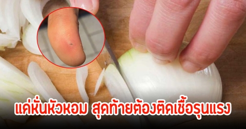 นึกไม่ถึง! สาวเตือน หั่นหัวหอมเจอเศษฝังลึกในนิ้ว สุดท้ายต้องติดเชื้อรุนแรง