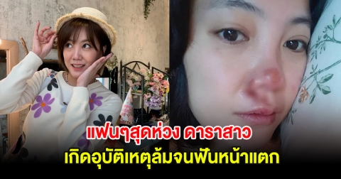 แฟนๆสุดห่วง ดาราสาว เกิดอุบัติเหตุล้มจนฟันหน้าแตก (ต่างประเทศ)