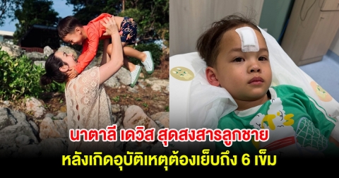 นาตาลี เดวิส สุดสงสารลูกชาย หลังเกิดอุบัติเหตุต้องเย็บถึง 6 เข็ม