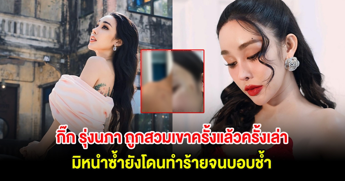 เพจดังเผย กิ๊ก รุ่งนภา ถูกสวมเขาครั้งแล้วครั้งเล่า มิหนำซ้ำยังโดนทำร้ายจนบอบช้ำ