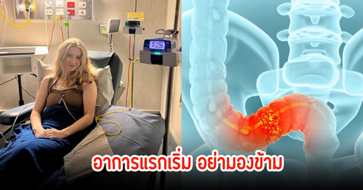 ช็อก! สาววัยแค่ 20 ปี ตรวจพบมะเร็งร้าย หมอเผยอยู่ได้อีกไม่นาน ย้ำอาการแรกเตือนหนุ่มสาวทุกคนอย่าชะล่าใจ