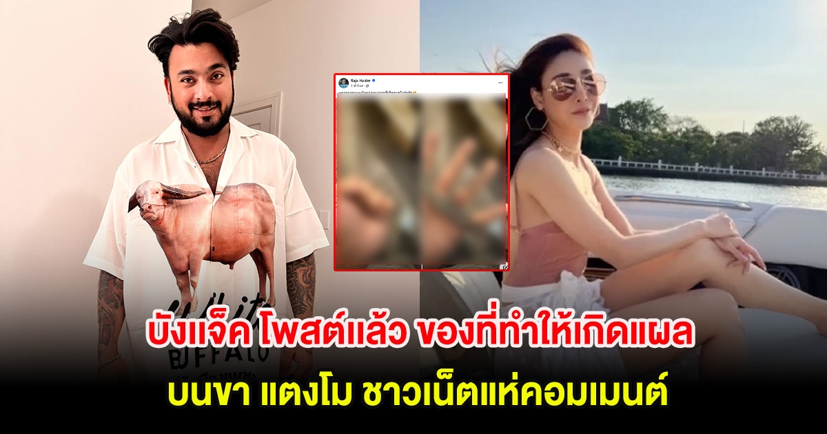 บังเเจ็ค โพสต์เเล้ว สิ่งของที่ทำให้เกิดแผลบนขา แตงโม ชาวเน็ตแห่คอมเมนต์