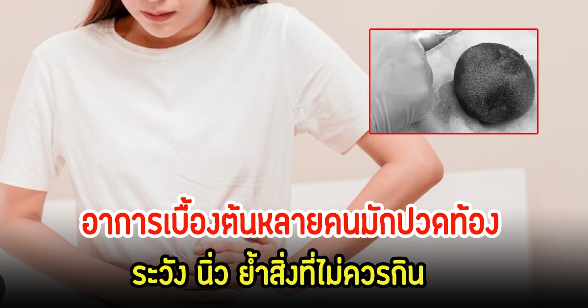 หมอช็อก! ชายวัย 50 ปี เป็นเคสหายาก พบนิ่วใหญ่เท่าไข่ห่าน ย้ำสิ่งที่ไม่ควรกิน และอาการเบื้องต้นหลายคนมักปวดท้อง