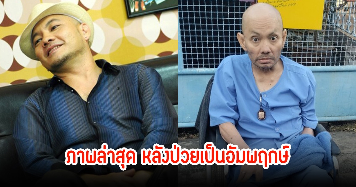 ภาพล่าสุด อดีตนักร้องดัง ป่วยเป็นอัมพฤกษ์ซีกซ้ายมา 10 กว่าปี