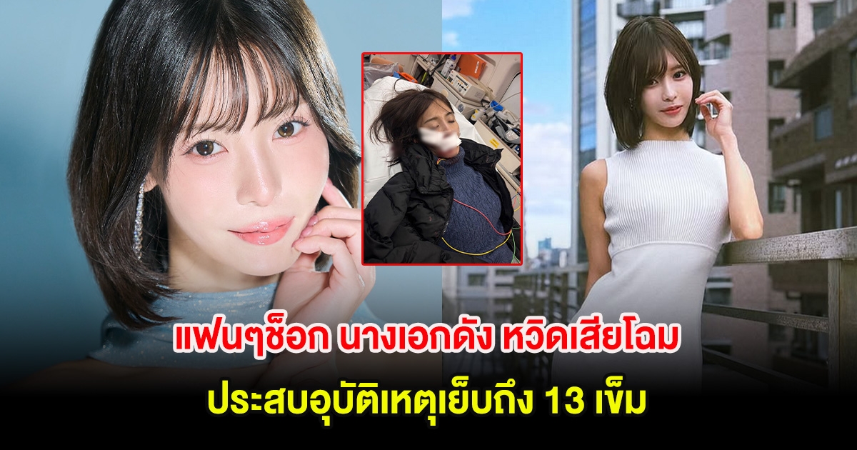 แฟนๆช็อก นางเอกดัง หวิดเสียโฉม ประสบอุบัติเหตุเย็บถึง 13 เข็ม (ต่างประเทศ)