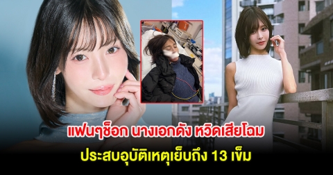 แฟนๆช็อก นางเอกดัง หวิดเสียโฉม ประสบอุบัติเหตุเย็บถึง 13 เข็ม (ต่างประเทศ)