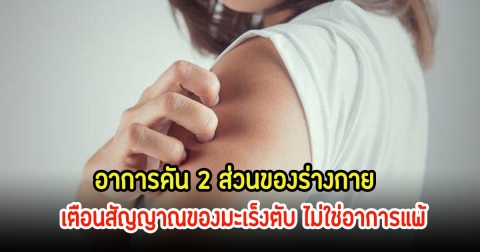 เตือน! อาการคัน 2 ส่วนของร่างกาย สัญญาณของมะเร็งตับ ไม่ใช่อาการแพ้ อย่าชะล่าใจ