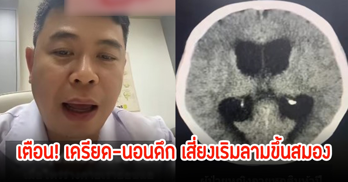 หมอเตือน! เครียด-นอนดึก ทำให้ร่างกายภูมิตก เสี่ยงเป็นเริมลามขึ้นสมอง