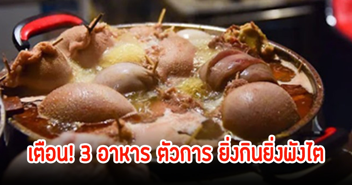 แพทย์เตือน! 3 อาหาร ตัวการ ยิ่งกินยิ่งพังไต หลายคนเป็นเมนูโปรดกินทุกวัน