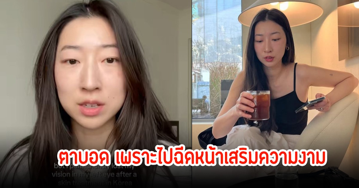 ช็อก! ศิลปินสาว ฉีดหน้าเสริมความงาม สุดท้ายตาบอด เครียดหนักจ่อฟ้องคลินิก (ข่าวต่างประเทศ)