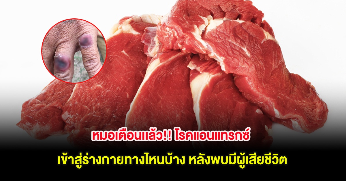 หมอเตือนเเล้ว!! โรคแอนแทรกซ์ เข้าสู่ร่างกายทางไหนบ้าง หลังพบมีผู้เสียชีวิต