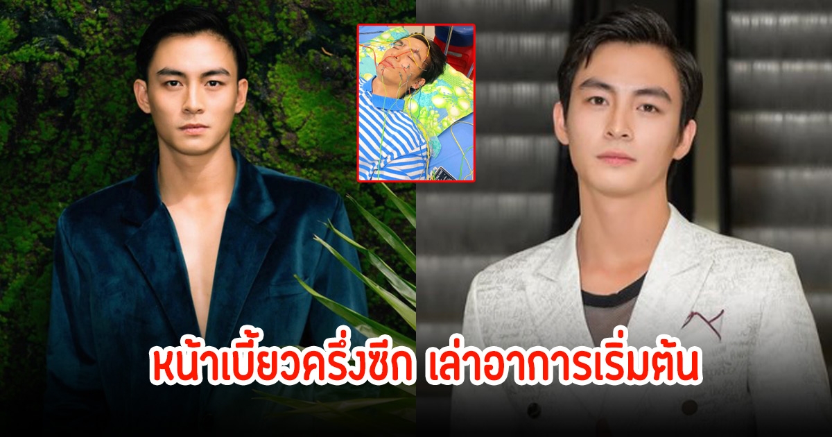 ช็อก! ดาราหนุ่ม หน้าเบี้ยวครึ่งซีก พร้อมเล่าอาการเริ่มต้น (ข่าวต่างประเทศ)