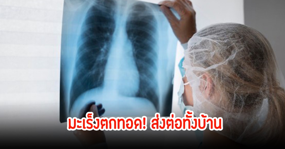 ช็อกทั้งบ้าน! สามีเสียชีวิตไม่นาน ภรรยาป่วยโรคมะเร็งชนิดเดียวกัน สาเหตุเพราะพฤติกรรมเคยตัวที่ทำในบ้าน