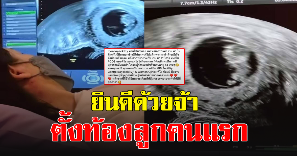 นักร้องสาว มน ชุติมน ล่าสุดออกมาประกาศข่าวดีแล้ว กำลังตั้งท้องลูกคนแรก