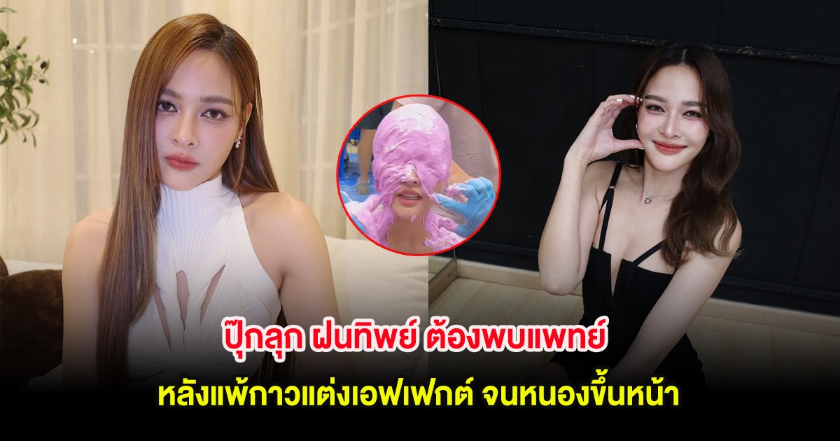 ปุ๊กลุก ฝนทิพย์ ต้องพบแพทย์ หลังแพ้กาวแต่งเอฟเฟกต์ จนหนองขึ้นหน้า