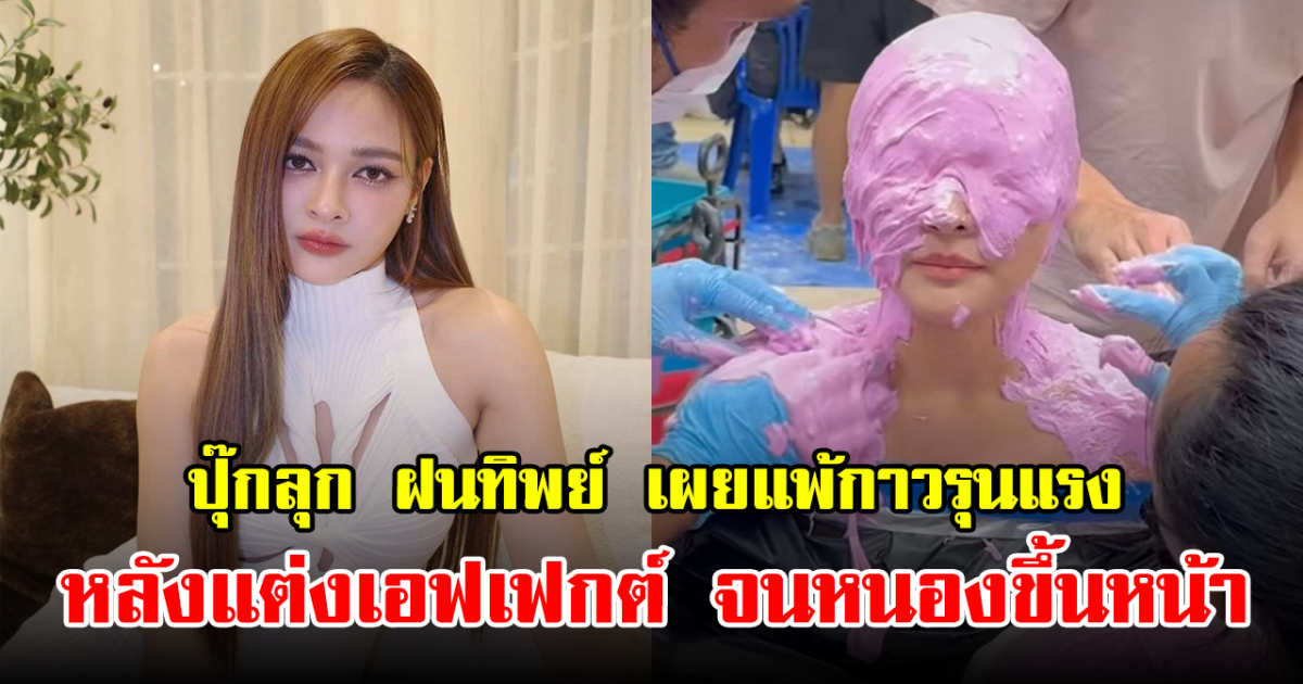 ปุ๊กลุก ฝนทิพย์ ต้องพบแพทย์ หลังแพ้กาวแต่งเอฟเฟกต์ จนหนองขึ้นหน้า